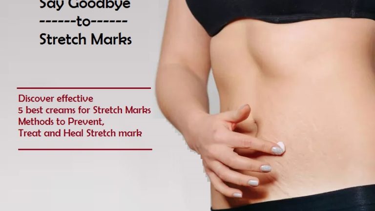 Stretch Marks: Discover effective 5 best creams, methods to Prevent, Treat and Heal